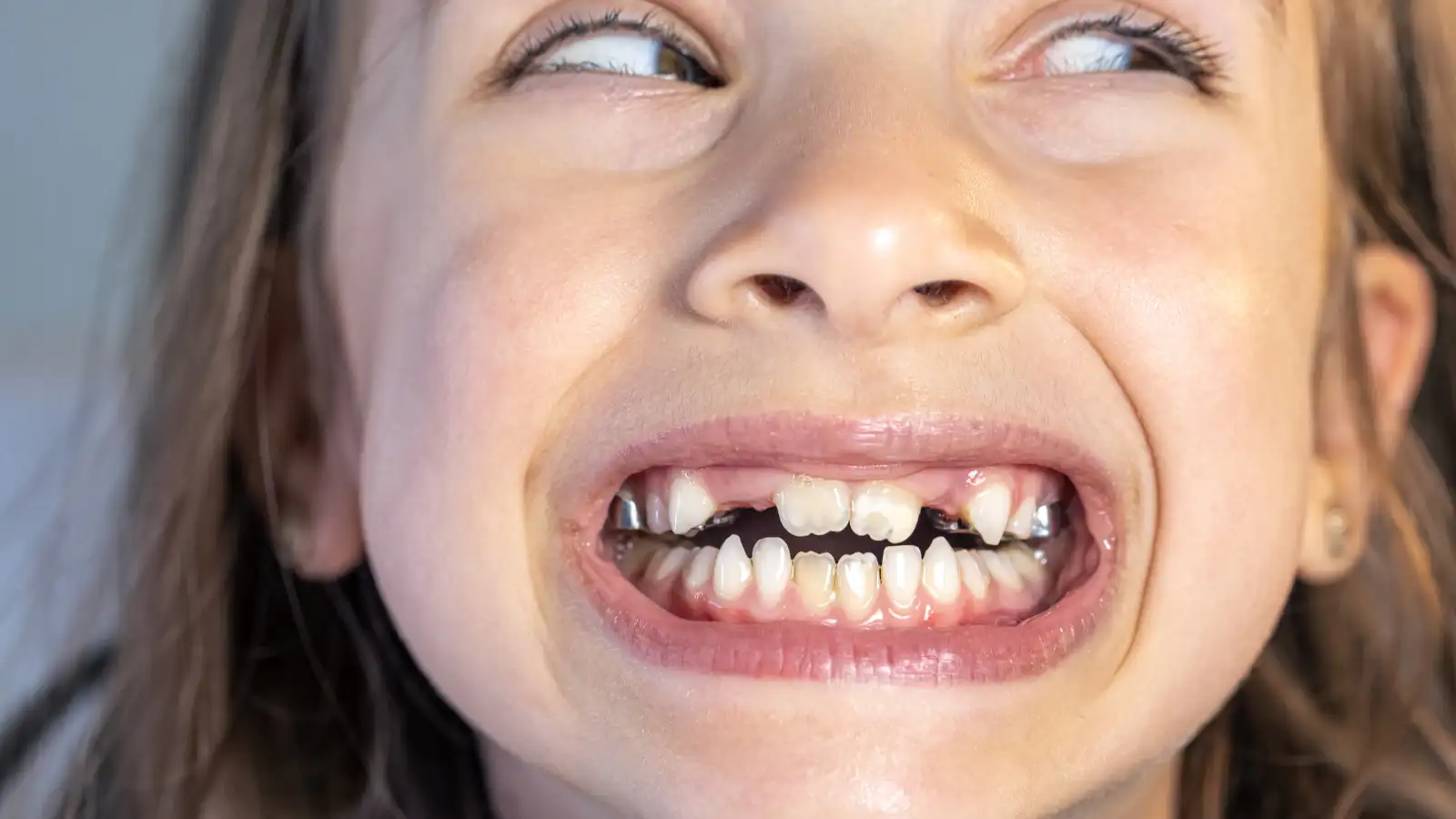 Os 5 Nomes dos Dentes que Todo Pai Precisa Ensinar Hoje