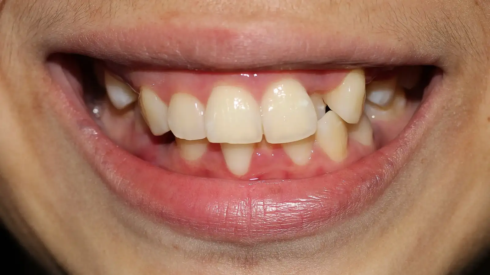 Os 5 Nomes dos Dentes que Todo Pai Precisa Ensinar Hoje